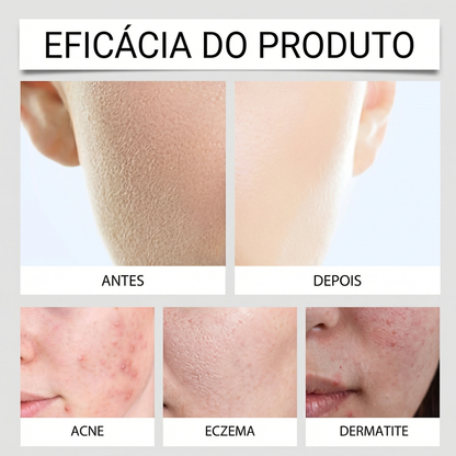 345 Relief Cream Ver.2 com textura leve e rápida absorção sem obstruir os poros.