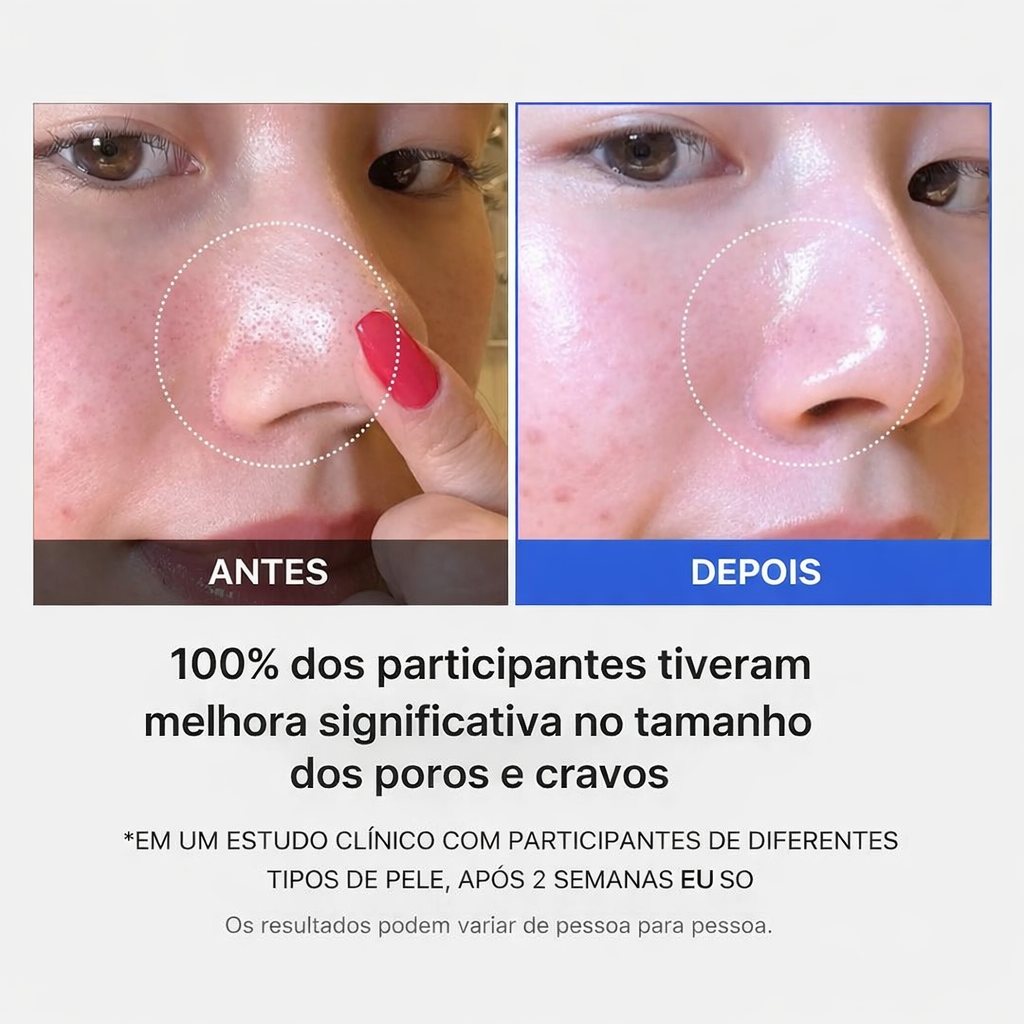 Discos faciais coreanos para limpeza profunda dos poros e cuidado da pele oleosa